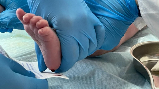 Неонатальный скрининг помог выявить редкие заболевания у 20 югорских младенцев
