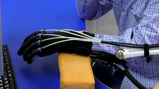 Роботизированная перчатка поможет лангепасцам восстановиться после инсульта